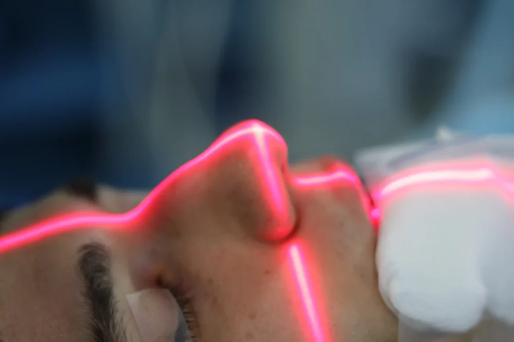 rinoplastia doctor roy acosta