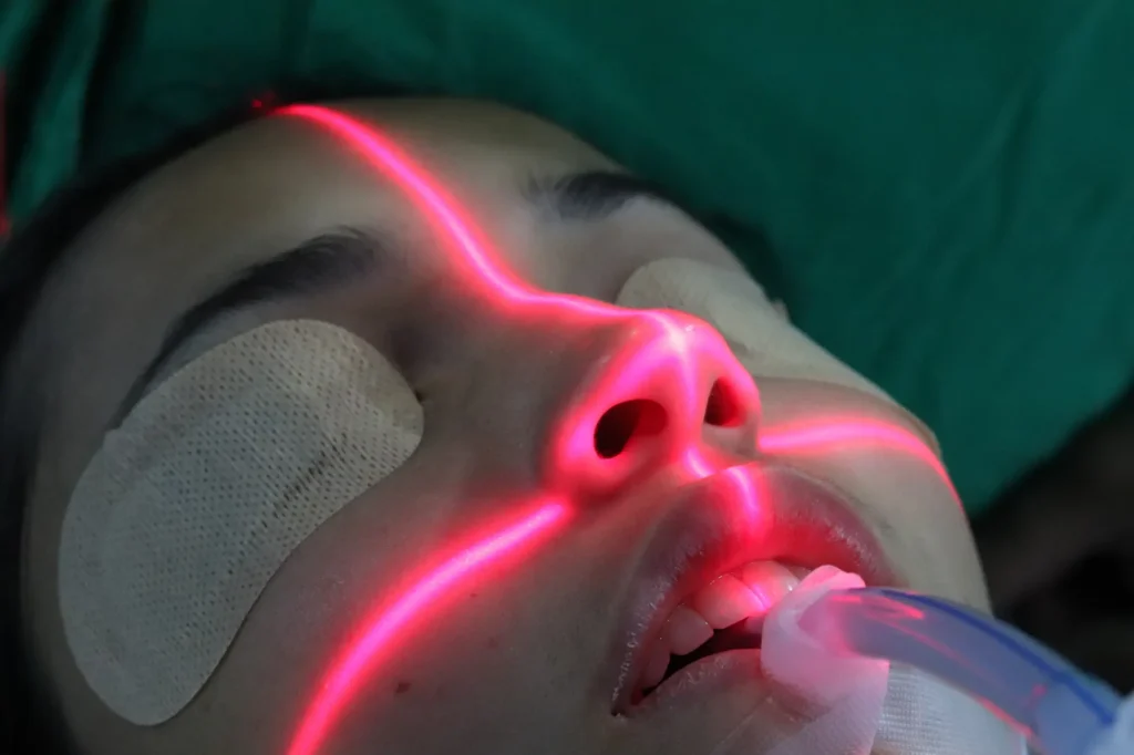 paso a paso rinoplstia abierta