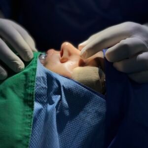 Cirugía para ronquidos y apnea del sueño - Dr. Roy Acosta