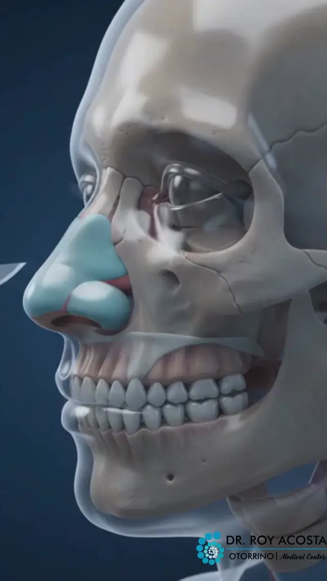 Anatomía nasal en rinoplastia ultrasónica
